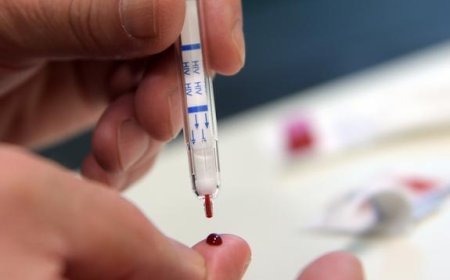 SO Aponta que Jovens Entre 15 e 24 Anos Concentraram 30% das Novas Infecções por VIH