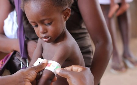 “Analista defende reforço dos cuidados primários para combater a desnutrição”