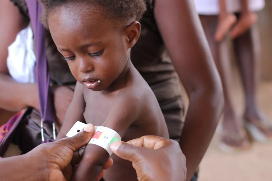 “Analista defende reforço dos cuidados primários para combater a desnutrição”
